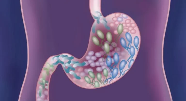 8 Healthy Habits That Support Gut Health and Acid Balance 8 Healthy Habits That Support Gut Health and Acid Balance