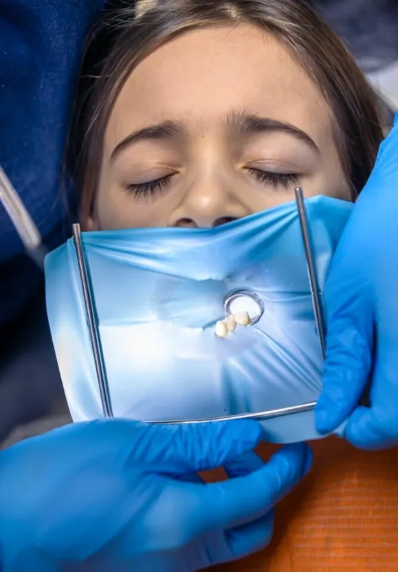 What to Know About Dental Dams for Oral Procedures and Patient Protection What to Know About Dental Dams for Oral Procedures and Patient Protection